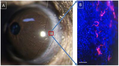 Resident Innate Immune Cells in the Cornea